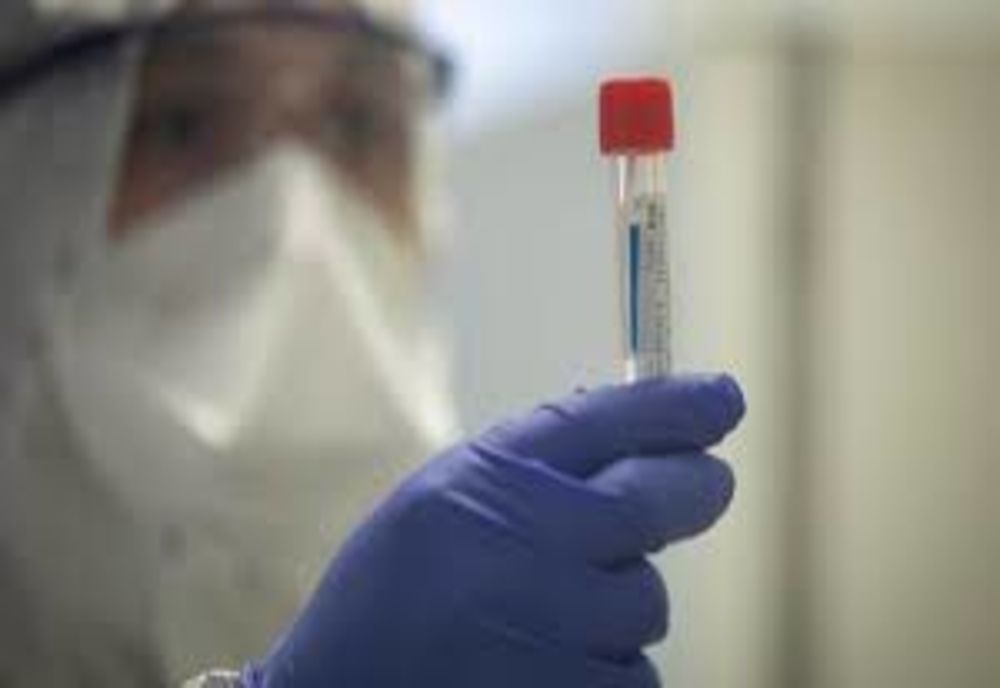 SJU Bistrița vrea să achiziționeze un sistem pentru diagnosticarea rapidă a CoVID-19! Investiția s-ar ridica la peste 100.000 de euro