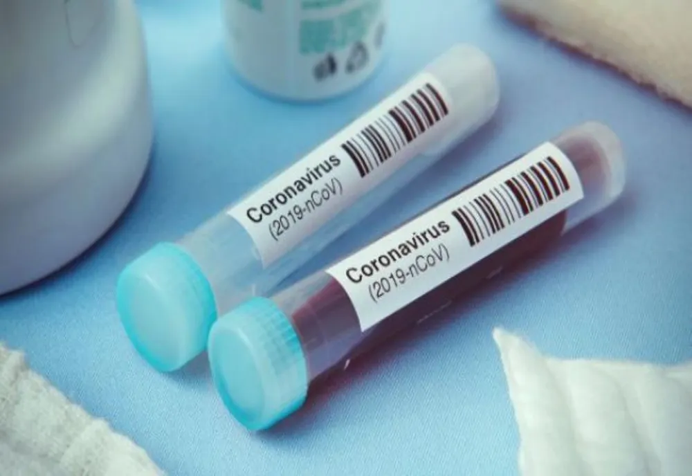 Încă 59 de cazuri noi de infectare cu coronavirus, în România. Totalul a ajuns la 367