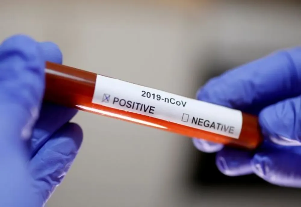 Încă 21 de bistrițeni, infectați cu CoVid-19, în ultimele 24 de ore! Situația la nivel național