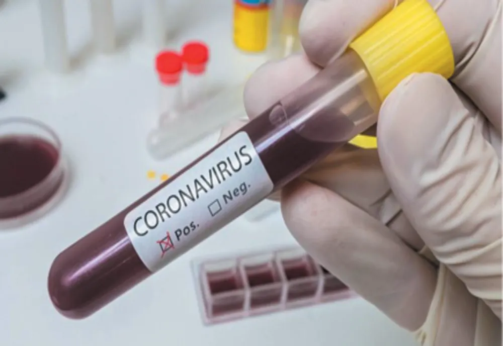 Încă 13 bistrițeni cu CoVid-19! Alți 5 s-au vindecat. Aproape 800 de cazuri la nivel național