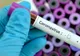 Bistrițeancă revenită din Franța, internată în Secția de Boli Infecțioase, cu suspiciune de coronavirus! Alte două probe au ieșit NEGATIVE