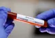 Încă 21 de bistrițeni, infectați cu CoVid-19, în ultimele 24 de ore! Situația la nivel național
